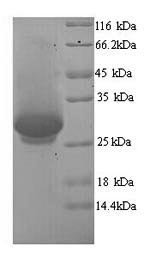 Greater than 90% as determined by SDS-PAGE.Recombinant Human Dynamin-1 (DNM1) Protein (His)