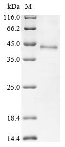 Greater than 85% as determined by SDS-PAGE.Recombinant Human Dipeptidase 1 (DPEP1) Protein (His)