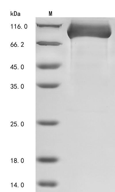 Greater than 90% as determined by SDS-PAGE.Recombinant Human Dipeptidyl Peptidase 4 (DPP4) Protein (His)