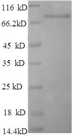 Greater than 90% as determined by SDS-PAGE.Recombinant Rat Dipeptidyl Aminopeptidase-Like Protein 6 (DPP6) Protein (His)