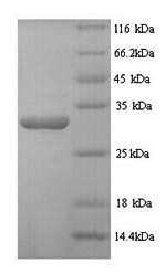 Greater than 90% as determined by SDS-PAGE.Recombinant Human Desmoplakin (DSP) Protein (His)