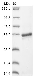 Greater than 90% as determined by SDS-PAGE.Recombinant Rat Endothelin-1 (EDN1) Protein (hFc)