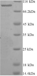 Greater than 90% as determined by SDS-PAGE.Recombinant Mouse Elongation Factor 2 (EEF2) Protein (His&Myc)