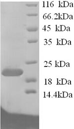 Greater than 90% as determined by SDS-PAGE.Recombinant Rat Ephrin-A1 (EFNA1) Protein (His)