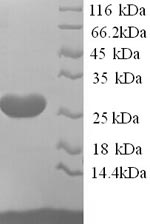 Greater than 90% as determined by SDS-PAGE.Recombinant Rat Ephrin-A5 (EFNA5) Protein (His)