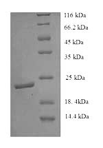 Greater than 90% as determined by SDS-PAGE.Recombinant Mouse Ephrin-B3 (EFNB3) Protein (His)