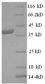 Greater than 90% as determined by SDS-PAGE.Recombinant Human Eukaryotic Translation Initiation Factor 4 Gamma 1 (EIF4G1) Protein (His)