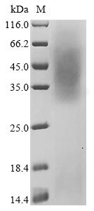 Greater than 90% as determined by SDS-PAGE.Recombinant Mouse Beta-Enolase (ENO3) Protein (His)