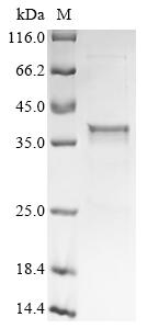 Greater than 90% as determined by SDS-PAGE.Recombinant Mouse Ectonucleotide Pyrophosphatase/Phosphodiesterase Family Member 1 (ENPP1) Protein (His)