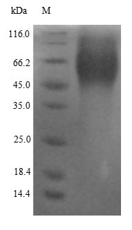 Greater than 90% as determined by SDS-PAGE.Recombinant Human Estrogen Receptor (ESR1) Protein (His)