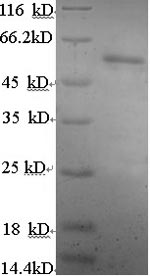Greater than 90% as determined by SDS-PAGE.Recombinant Human Estrogen Receptor Beta (ESR2) Protein (His)
