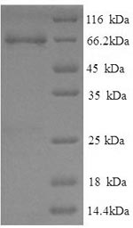 Greater than 90% as determined by SDS-PAGE.Recombinant Pig Electron Transfer Flavoprotein-Ubiquinone Oxidoreductase, Mitochondrial (ETFDH) Protein (His)