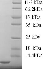 Greater than 90% as determined by SDS-PAGE.Recombinant Human High Affinity Immunoglobulin Epsilon Receptor Subunit Gamma (FCER1G) Protein (His)