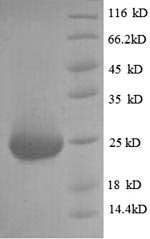 Greater than 90% as determined by SDS-PAGE.Recombinant Rat Fibroblast Growth Factor 23 (FGF23) Protein (His)