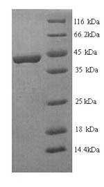 Greater than 90% as determined by SDS-PAGE.Recombinant Human Fibroblast Growth Factor Receptor 3 (FGFR3) Protein (His)