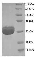 Greater than 90% as determined by SDS-PAGE.Recombinant Human Filaggrin (FLG) Protein (His)