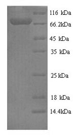 Greater than 90% as determined by SDS-PAGE.Recombinant Human Fucose-1-Phosphate Guanylyltransferase (FPGT) Protein (His)