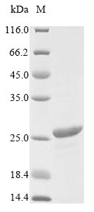 Greater than 85% as determined by SDS-PAGE.Recombinant Helicobacter Pylori Bacterial Non-Heme Ferritin (FTNA) Protein (His)