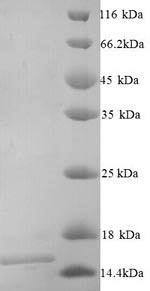 Greater than 90% as determined by SDS-PAGE.Recombinant Mouse Frataxin, Mitochondrial (FXN) Protein (His)