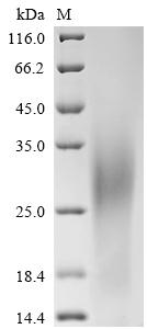 Greater than 85% as determined by SDS-PAGE.Recombinant Human Glucose-6-Phosphatase (G6PC1) Protein (His)