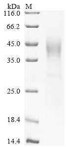 Greater than 90% as determined by SDS-PAGE.Recombinant Human Glucose-6-Phosphatase (G6PC1) Protein (His-sumostar)