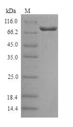 Greater than 90% as determined by SDS-PAGE.Recombinant Human Galactocerebrosidase (GALC) Protein (His)