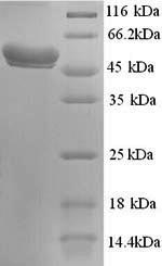 Greater than 90% as determined by SDS-PAGE.Recombinant Human N-Acetylgalactosamine-6-Sulfatase (GALNS) Protein (His)