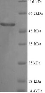 Greater than 90% as determined by SDS-PAGE.Recombinant Human Vitamin D-Binding Protein (GC) Protein (His-SUMOSTAR)