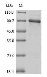 Greater than 85% as determined by SDS-PAGE.Recombinant Mouse Vitamin D-Binding Protein (GC) Protein (His-SUMOSTAR)