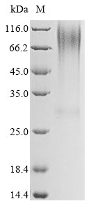 Greater than 90% as determined by SDS-PAGE.Recombinant Human Glucagon Receptor (GCGR) Protein (His)