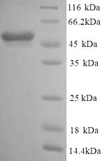 Greater than 90% as determined by SDS-PAGE.Recombinant Mouse Glial Fibrillary Acidic Protein (GFAP) Protein (His)