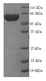 Greater than 90% as determined by SDS-PAGE.Recombinant Human Platelet Glycoprotein Ib Alpha Chain (GP1BA) Protein (His)