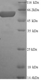 Greater than 90% as determined by SDS-PAGE.Recombinant Rat Glypican-3 (GPC3) Protein (His)