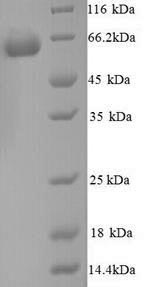 Greater than 90% as determined by SDS-PAGE.Recombinant Mouse Glucose-6-Phosphate Isomerase (GPI) Protein (His)