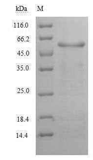 Greater than 90% as determined by SDS-PAGE.Recombinant Human Alanine Aminotransferase 1 (GPT) Protein (His)