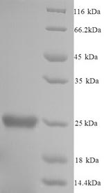 Greater than 90% as determined by SDS-PAGE.Recombinant Mouse Glutathione S-Transferase P 1 (GSTP1) Protein (His)