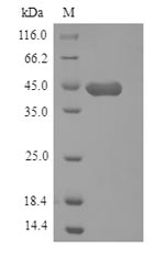 Greater than 90% as determined by SDS-PAGE.Recombinant Mouse Hyaluronan And Proteoglycan Link Protein 1 (HAPLN1) Protein (His)