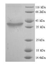 Greater than 90% as determined by SDS-PAGE.Recombinant Mouse Hyaluronan Synthase 2 (HAS2) Protein (His)