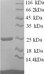 Greater than 90% as determined by SDS-PAGE.Recombinant Human Hepatitis A Virus Cellular Receptor 2 (HAVCR2) Protein (His)