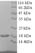 Greater than 90% as determined by SDS-PAGE.Recombinant Mouse Hemoglobin Subunit Alpha (HBA) Protein (His)