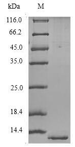 Greater than 90% as determined by SDS-PAGE.Recombinant Human Orexin Receptor Type 2 (HCRTR2) Protein (His/Tag-Free)