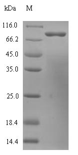Greater than 90% as determined by SDS-PAGE.Recombinant Human Histidine Decarboxylase (HDC) Protein (His)