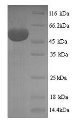 Greater than 90% as determined by SDS-PAGE.Recombinant Human Hexokinase-1 (HK1) Protein (His)