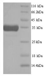 Greater than 90% as determined by SDS-PAGE.Recombinant Mouse Heme Oxygenase 1 (HMOX1) Protein (His)