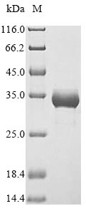 Greater than 85% as determined by SDS-PAGE.Recombinant Rat Heme Oxygenase 1 (HMOX1) Protein (His)