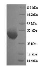 Greater than 90% as determined by SDS-PAGE.Recombinant Human Heterogeneous Nuclear Ribonucleoproteins A2/B1 (HNRNPA2B1) Protein (His)
