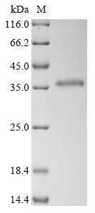 Greater than 90% as determined by SDS-PAGE.Recombinant Human Heterogeneous Nuclear Ribonucleoproteins A2/B1 (HNRNPA2B1) Protein (His)