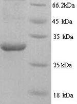 Greater than 90% as determined by SDS-PAGE.Recombinant Human Hnrnpl Protein (HNRNPL) Protein (His)