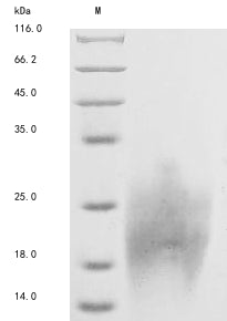 Greater than 90% as determined by SDS-PAGE.Recombinant Human Homeobox Protein Hox-A2 (HOXA2) Protein (His)