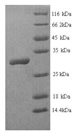 Greater than 90% as determined by SDS-PAGE.Recombinant Human Homeobox Protein Hox-B4 (HOXB4) Protein (His)